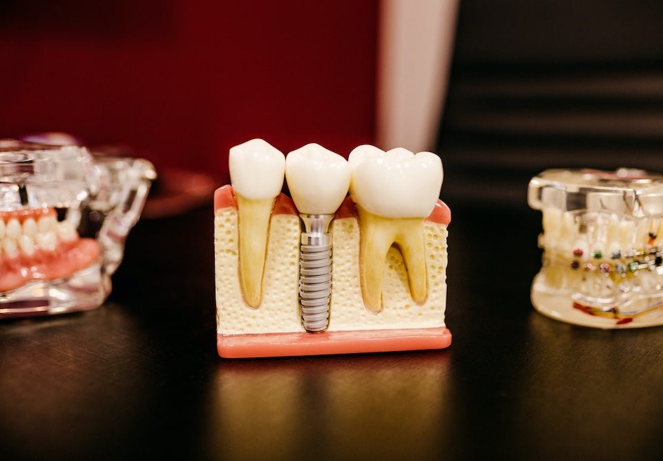 endodontist vs oral surgeon