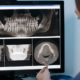 endodontic imaging