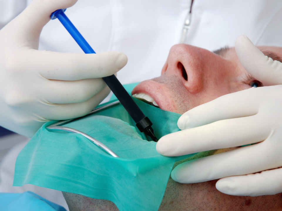 what causes a root canal